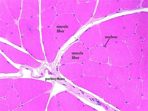 STRIATED, SKELETAL MUSCLE | Microanatomy Web Atlas | Gwen V. Childs, Ph.D.