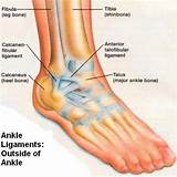 Pictures of Sprained Ankle Therapy