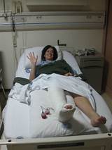 Broken Heel Recovery Images