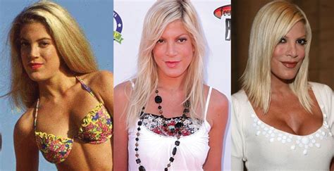 Tori Spelling Plastic Surgery Before And After Pictures