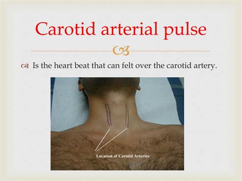 Ppt Jugular Venous Pulse And Carotid Arterial Pulse Powerpoint