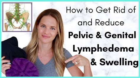 How To Get Rid Of Pelvic Or Genital Swelling Treatment Options For