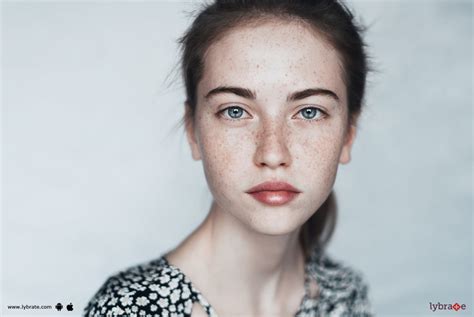 Know The Causes And Treatment Of Freckles By Dr Jyotsna Deo Lybrate