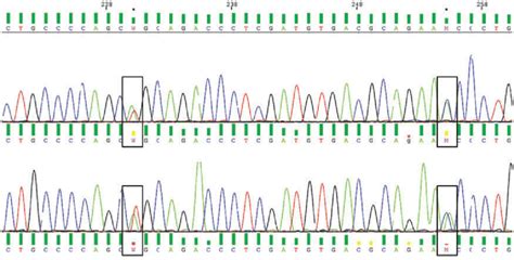 Sanger Sequencing Electrophoregram Showing A Composite Heterozygous Download Scientific Diagram