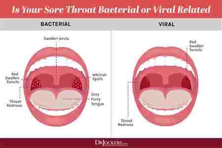 A sore throat is pain, scratchiness or irritation of the throat that often worsens when you swallow. Sore Throat Yellow Tongue Fever Numb How Sore Throat ...