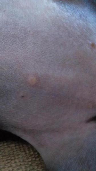 Yellow Pimple On Puppys Stomach Dog Forum