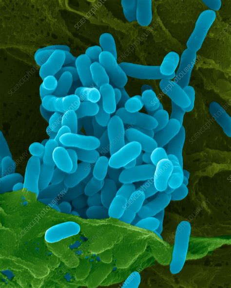 Pseudomonas Pseudomallei Bacterium Sem Stock Image C0322772
