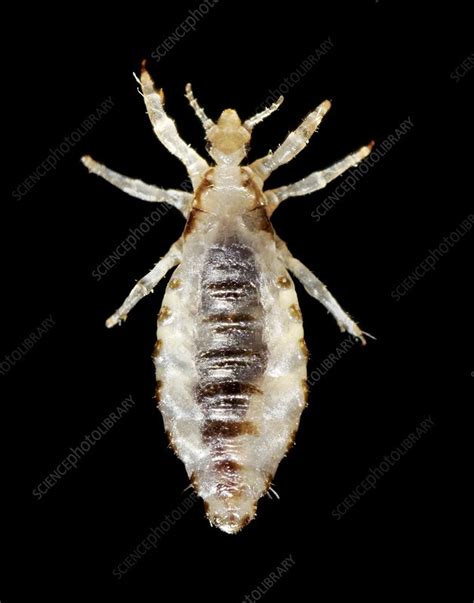Male Body Louse Stock Image C0211047 Science Photo Library