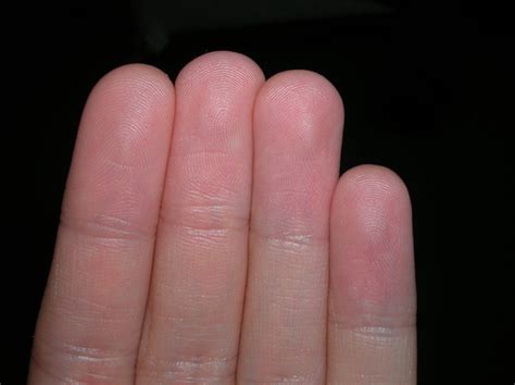 Free Finger Stock Photo - FreeImages.com