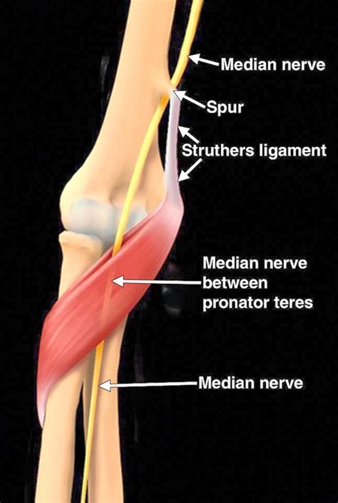 Anatomy Sms Struthers Ligament