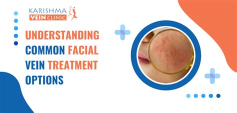 Understanding Common Facial Vein Treatment Options