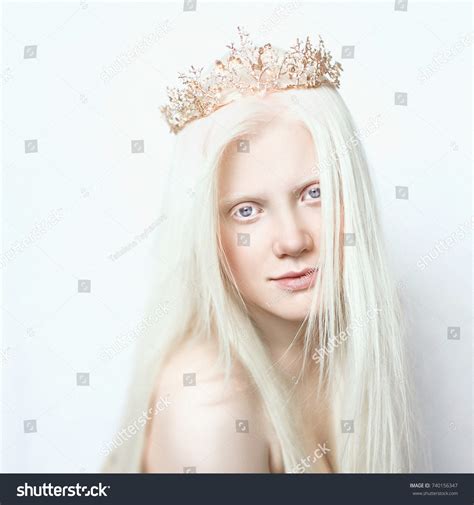 Albino Girl White Skin Natural Lips Foto Stock 740156347 Shutterstock