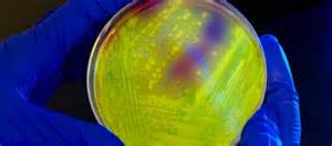 Novel Antibiotic For C Difficile Infection Gets Fdas Qidp Designation
