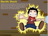 Photos of Electric Shock Symptoms
