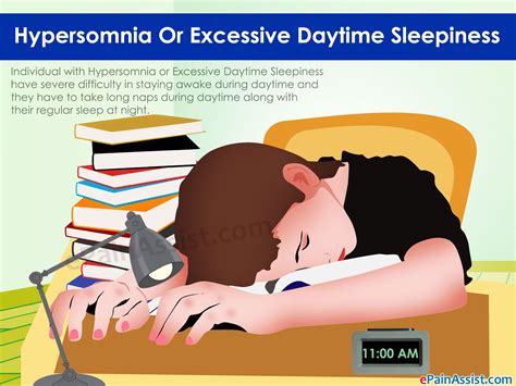 what is hypersomnia or excessive daytime sleepiness read sleep disor