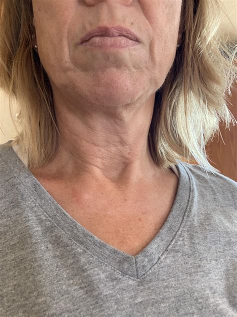 53 Years Old But My Face Looks Much Older Aside From A Facelift What Can I Do Already Taking