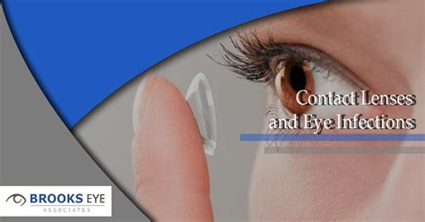 Contact Lenses And Eye Infections Brooks Eye Associates