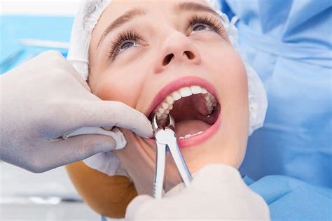 Tooth Extractions In West New York Dentist In West New York Nj 07093