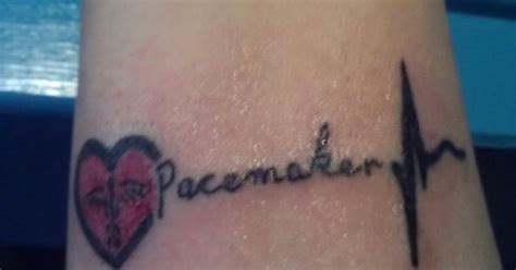 An implantable cardioverter defibrillator (icd) looks similar to a pacemaker, though slightly larger. Pacemaker medical id tattoo i just got | Pacemaker ...