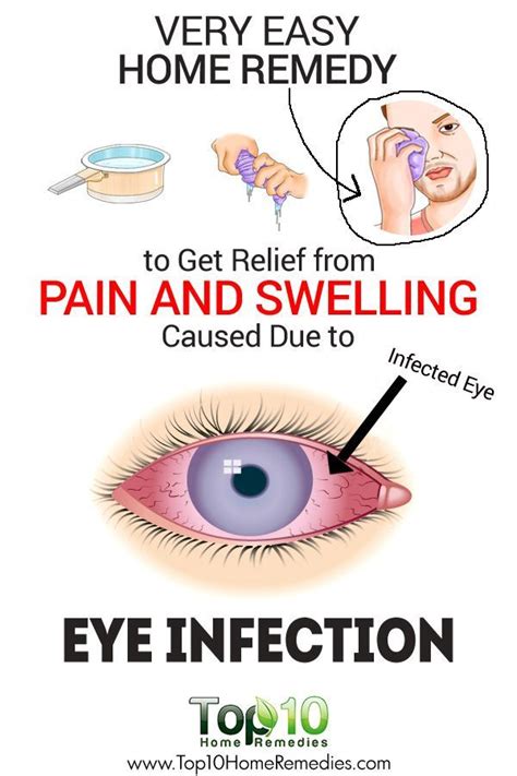 How Can I Treat An Eye Infection At Home Home