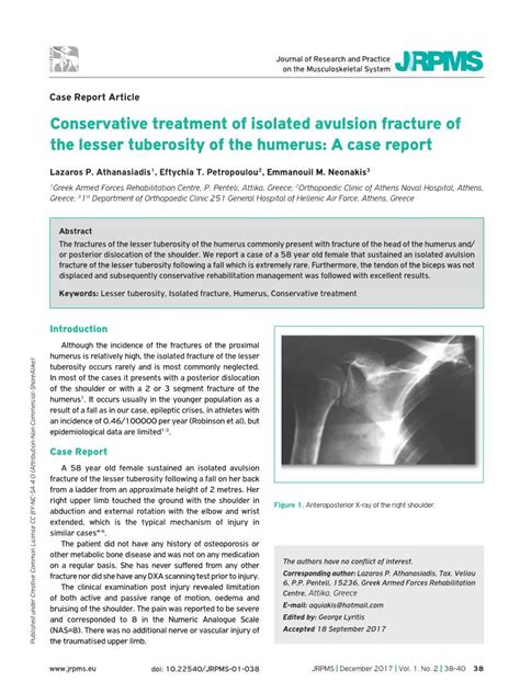 Conservative Treatment Of Isolated Avulsion Fracture Of The Lesser
