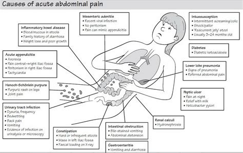 Acute Abdominal Pain In Children حكيم