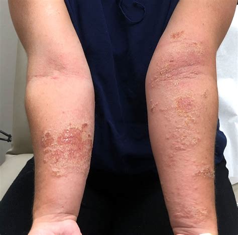 Skin Allergies Dermatologist Cape Town Dr Matete Mathobela