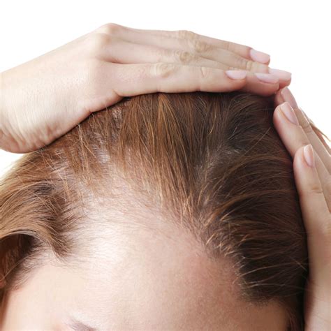 Causes Of Hair Loss In Women Moore Unique Skin Care