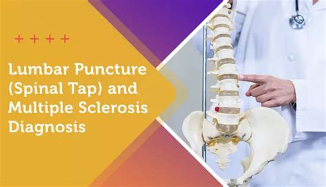 Lumbar Puncture Spinal Tap And Multiple Sclerosis Diagnosis Mymsteam