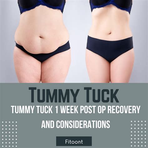 Tummy Tuck Week Post Op Recovery And Considerations Fitoont