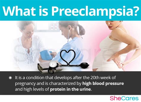 Preeclampsia During Pregnancy Symptoms And Causes Treatment And