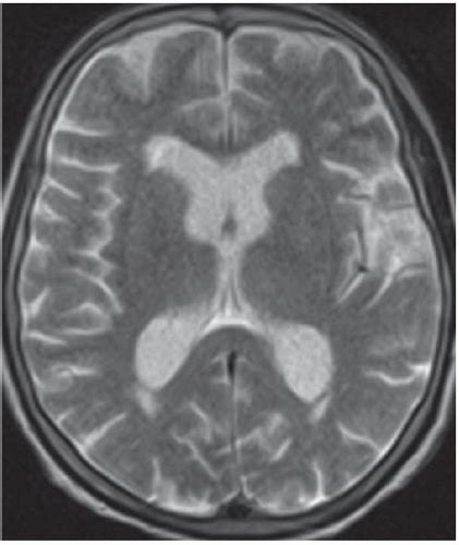 Neuroradiology Brain Radiology Key