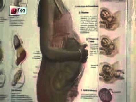 Diese arten erscheinen innerhalb der ihre symptome hängen von der anzahl der tumore, die sie haben, sowie von deren lage und größe ab. Fibrome utérin: symptomes et complications | Doovi