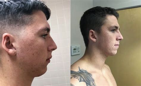 3 Ways To Train Your Jawline For A More Defined Look Justinboey