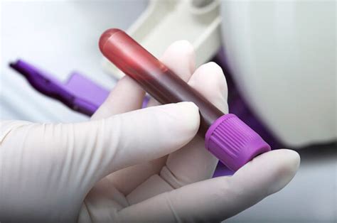 New Multi Cancer Early Detection Blood Test Study Opens Across Thames