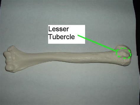Adductor tubercle femur greater trochanter head of femur intertrochanteric line lateral condyle of the femur lateral epicondyle of the femur lesser the word trochanter is derived from the greek words trechein to run and trochos meaning wheel. Biology 2250 > Baldwin > Flashcards > Appendicular ...