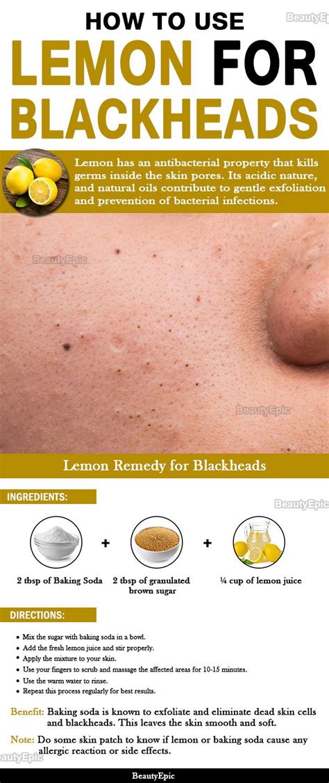 4 Easy Ways To Get Rid Of Blackheads Quickly With Lemon Healthy Skin