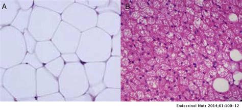 Adipose tissue is a form of loose connective tissue composed of adipocytes, fibroblasts, vascular endothelial cells, and some immune cells. Adipose tissue: Cell heterogeneity and functional ...
