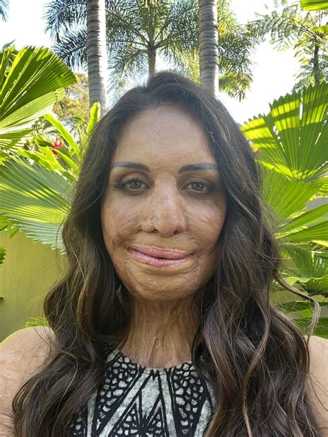 Turia Pitt Releases New Daily Positivity Podcast