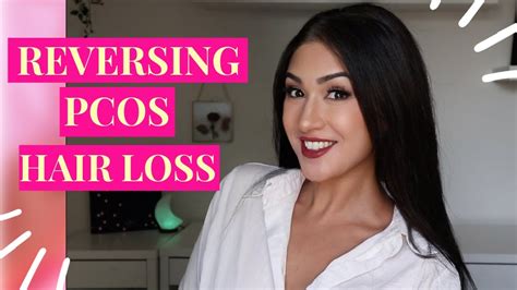 Reversing Pcos Hair Loss Youtube