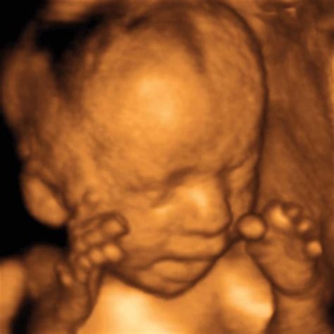 27 Weeks And 1 Day Pregnant Baby Fetal Progress Ultrasound