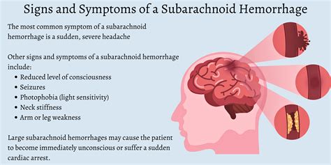 What Is A Subarachnoid Hemorrhage SAH