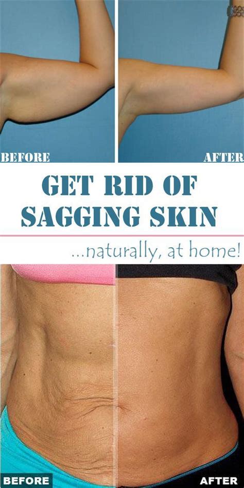 6 wonderful home remedies for sagging skin home remedies for skin skin remedies natural