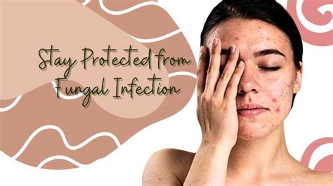 Fungal Infection Prevention And Natural Treatments