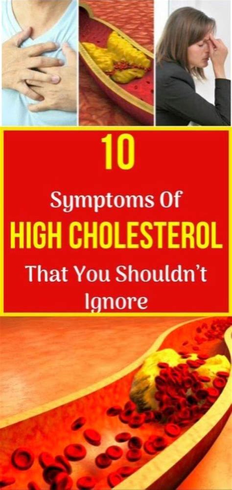 10 Symptoms Of High Cholesterol That You Shouldnt Ignore In 2020 High