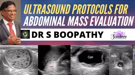 Protocols For Abdominal Mass Evaluation On Ultrasound Dr S Boopathy