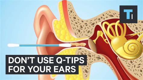 3 Ways To Remove Earwax With No Q Tips Super Clean Works Really Well