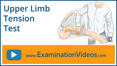Upper Limb Tension Test Youtube