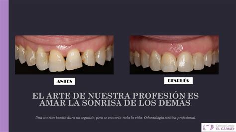 Clínica Dental El Carmen OdontologÍa EstÉtica Clínica Dental El Carmen