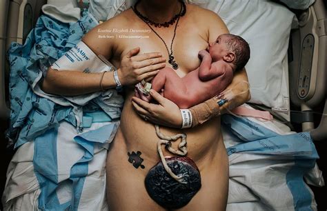 Winners Of S Best Birth Photo Contest Will Take Your Breath Away Nsfw Demilked